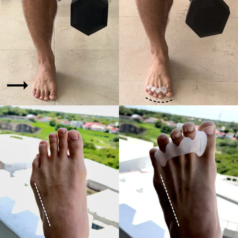 Toe Spacers Pallet - Image 2